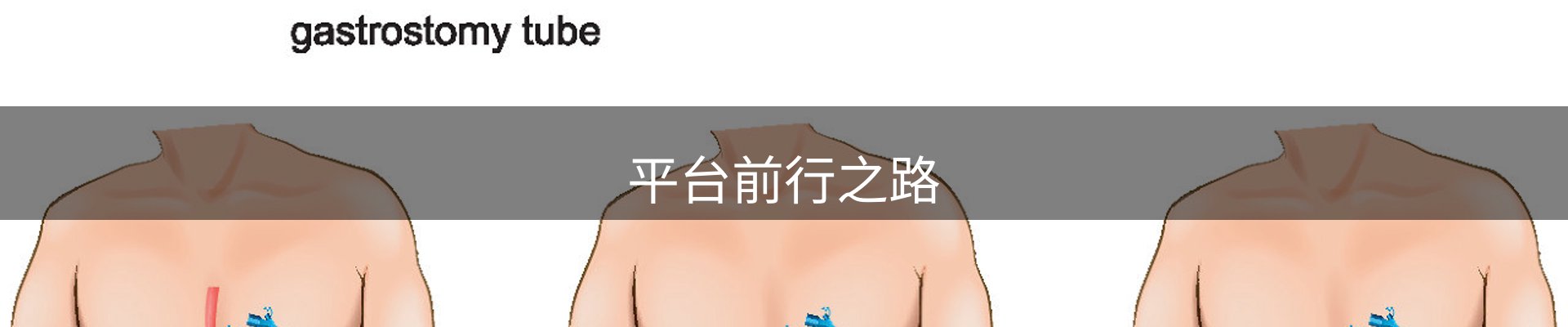平台前行之路